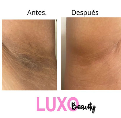 RESULTADOS JABÓN ACLARADOR LUXO